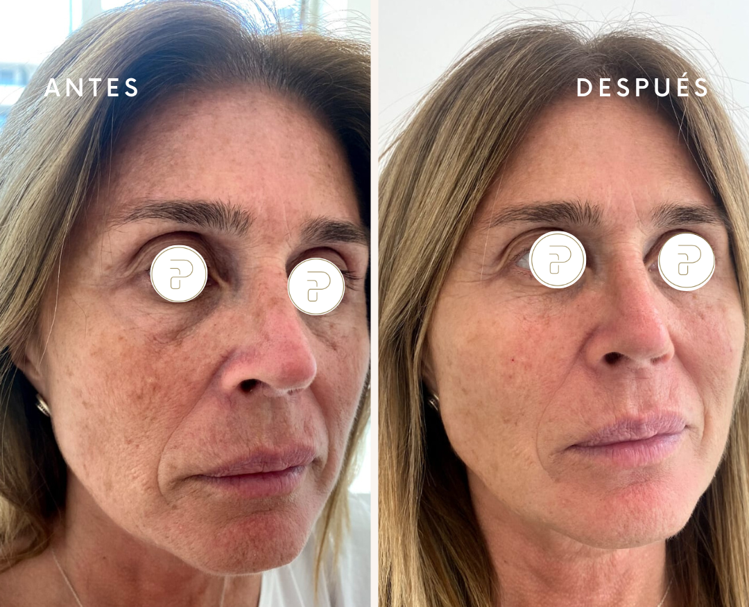 Caso de Uso de Long Lasting