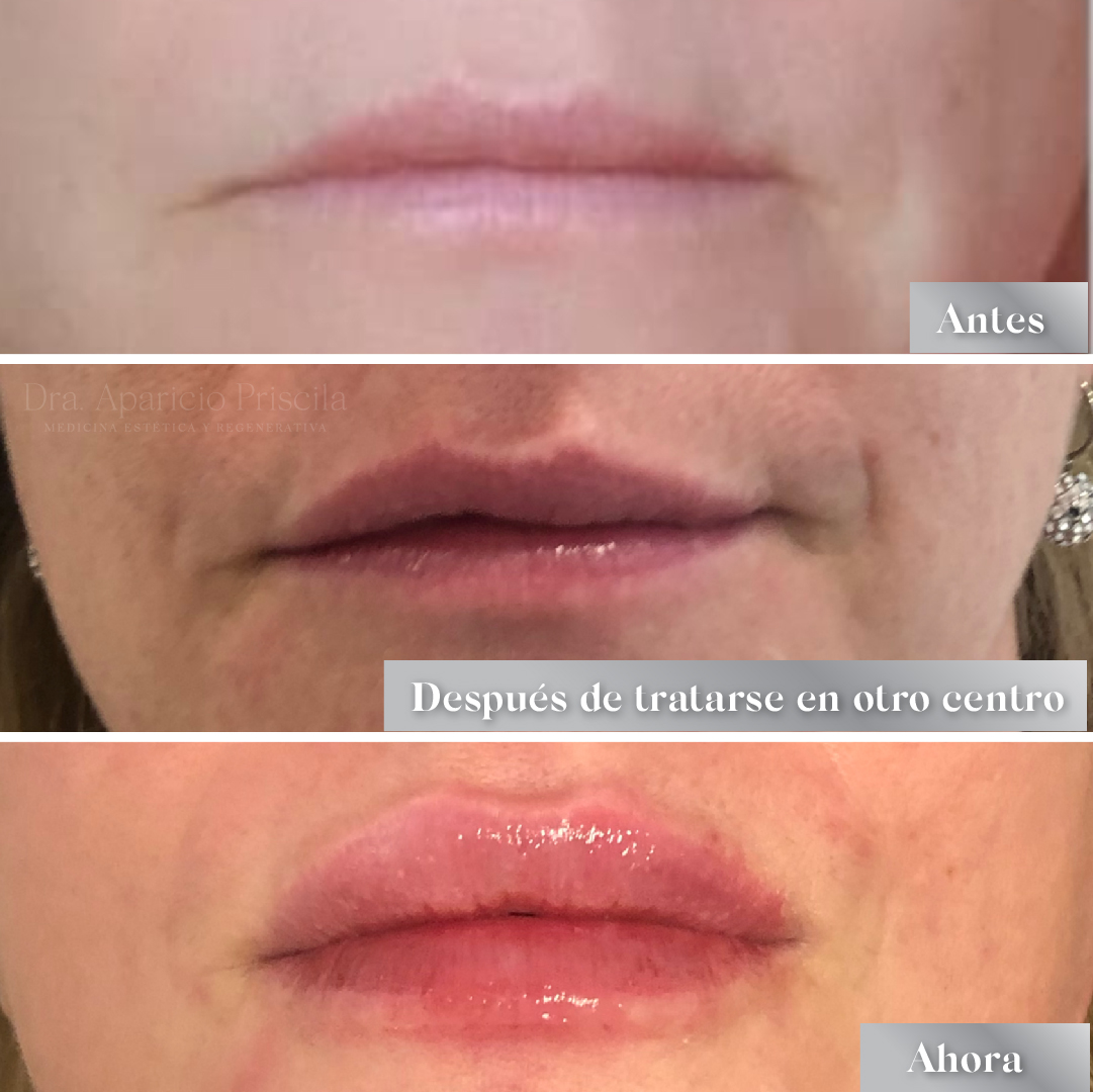 Caso de Uso de Labios