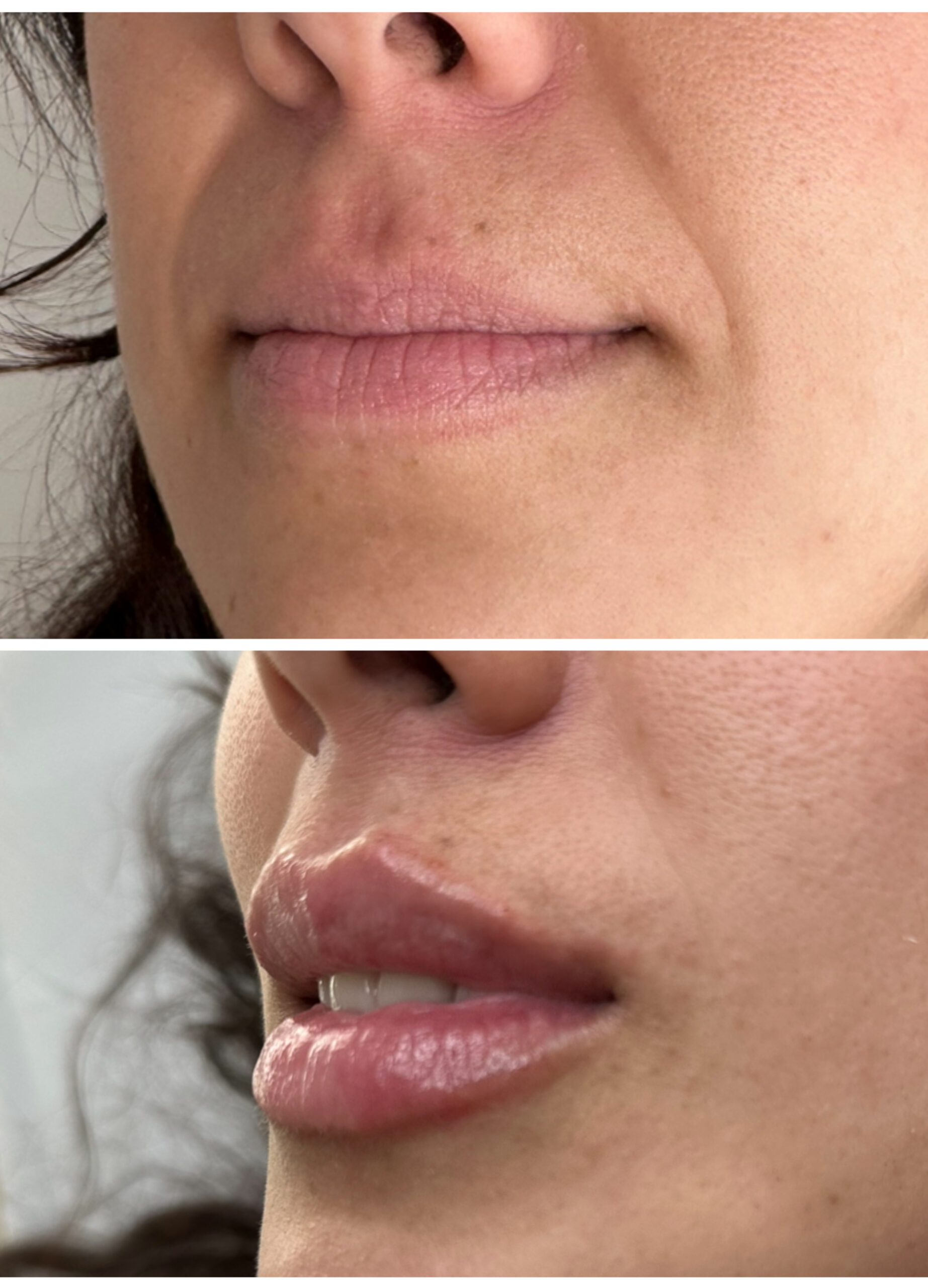 Caso de Uso de Labios
