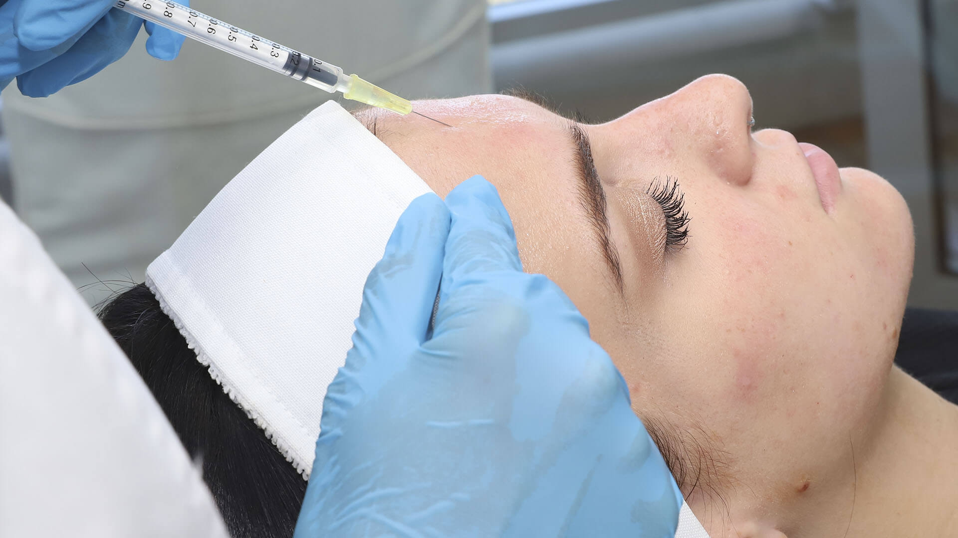Mesoterapia Facial con Vitaminas